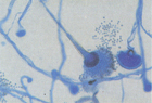 fungal tani_testi 1