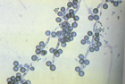 fungal tani testi 5