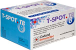 t-spot.tb lab. test