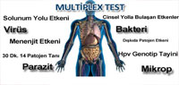 multipleks_testi