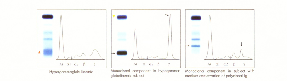 protein elektroforezi