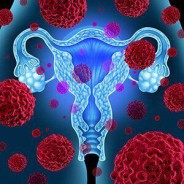 HPV İNFEKSİYONUNDA RAHİM AĞZI KANSERİNE İLERLEMENİN TEMEL TESTİ OLAN HPV mRNA HAKKINDA BİLGİLER